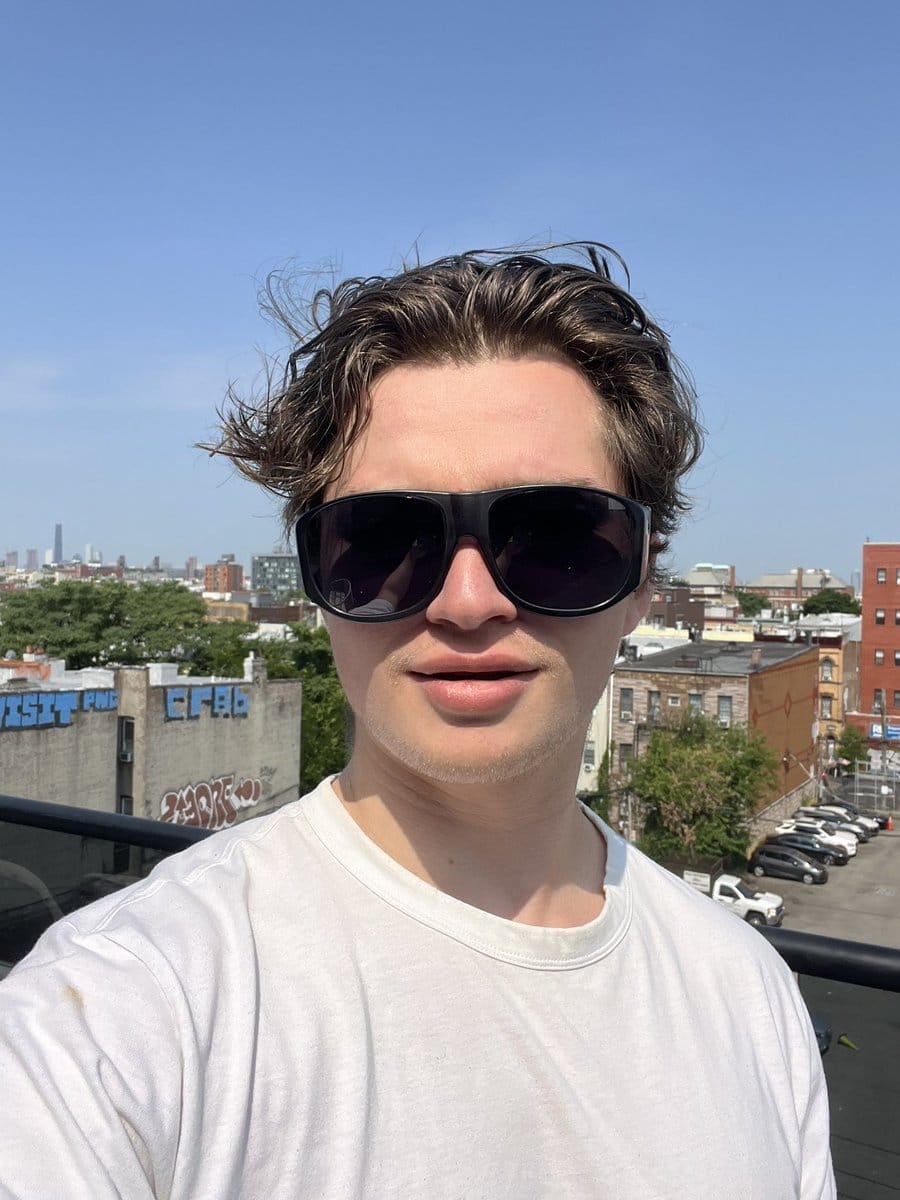 Anthony wearing sunglasses after SMILE eye surgery